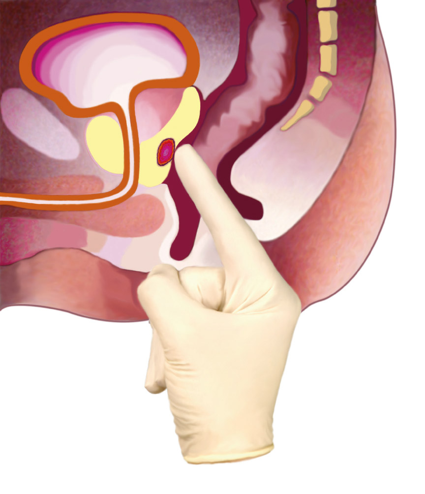 prostatic - Traducere în germană - exemple în română | Reverso Context