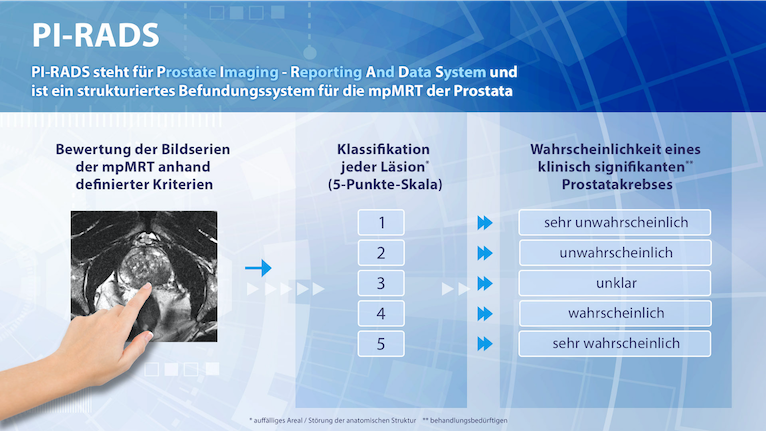 mrt prostata genauigkeit