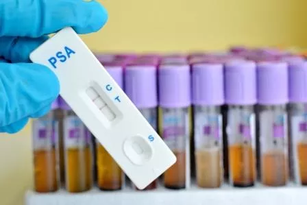 Fehlerhafte Studie - PSA-Test zu Unrecht in Verruf